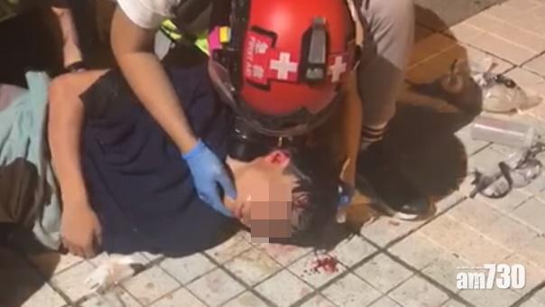 天水圍15歲少年疑被催淚彈擊中頭部情況危殆