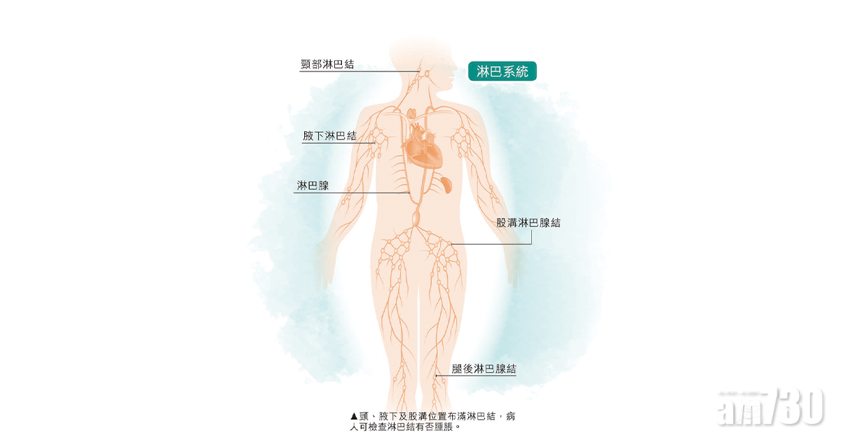 淋巴癌病人宜服免疫營養增強抵抗力