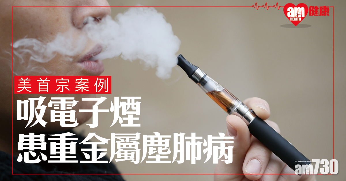 首宗案例 吸電子煙患重金屬塵肺病  