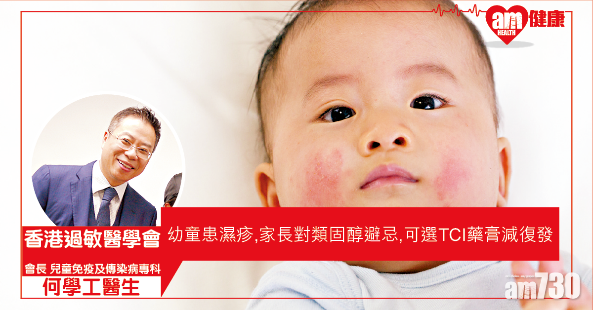 控制濕疹 讓兒童健康成長