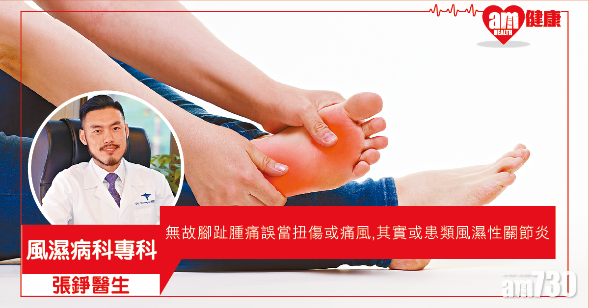 類風濕性關節炎 腳痛似扭親易忽略