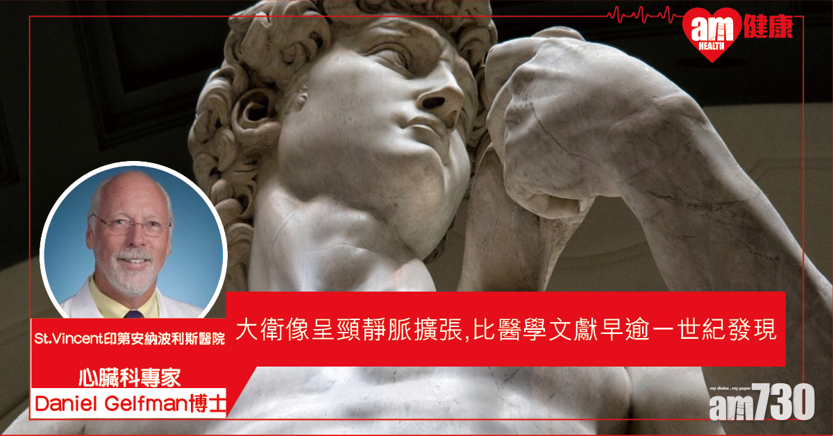 美醫生：大衛像呈頸靜脈擴張 比醫學文獻早逾一世紀發現 
