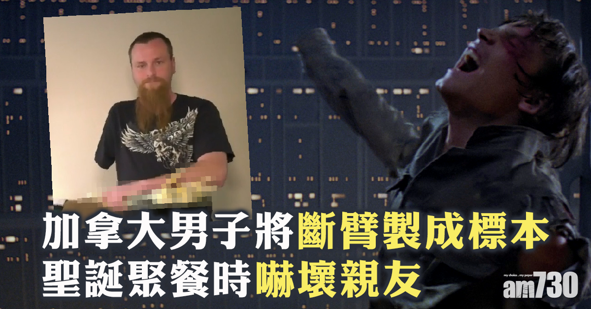 【搞嘢】加漢將斷臂製成標本 四處嚇親友