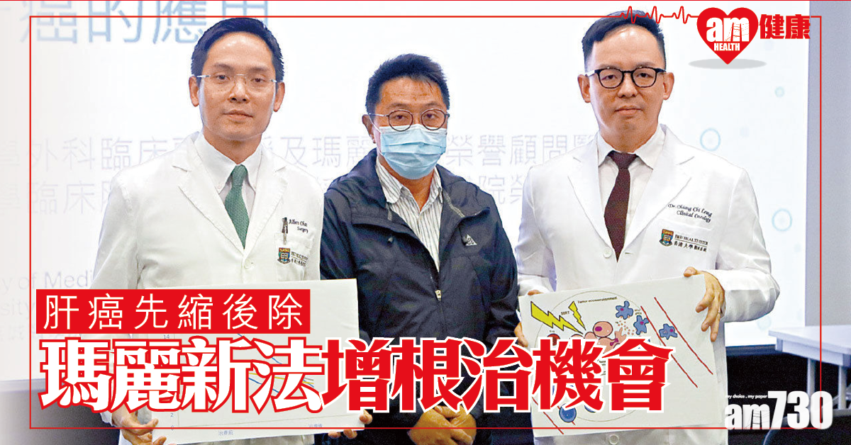 電療配免疫治療 新療法縮肝癌