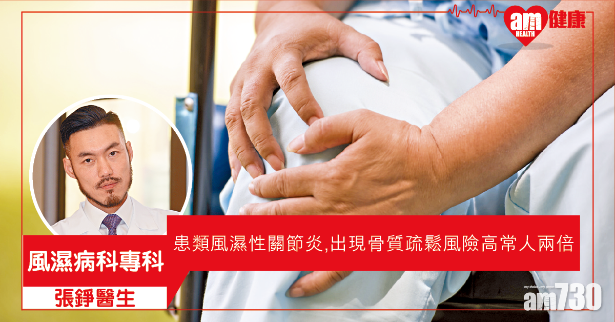 類風濕性關節炎破壞關節  嚴重或須輪椅代步