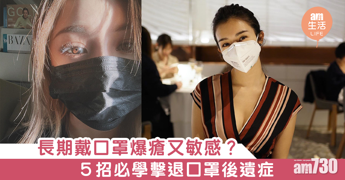 【武漢肺炎】長期戴口罩爆瘡又敏感 5招擊退口罩後遺症