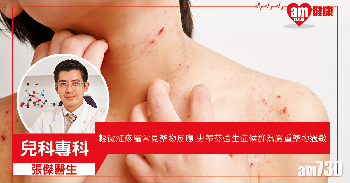 藥物敏感常見嗎？