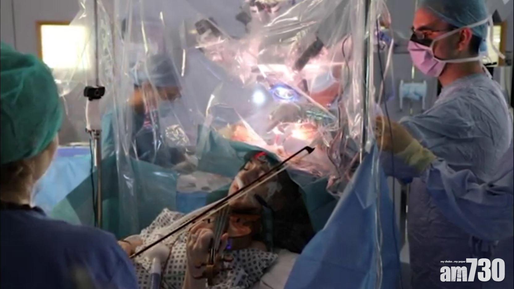 【協助定位】開腦切除腦腫瘤  小提琴家手術中持續演奏 