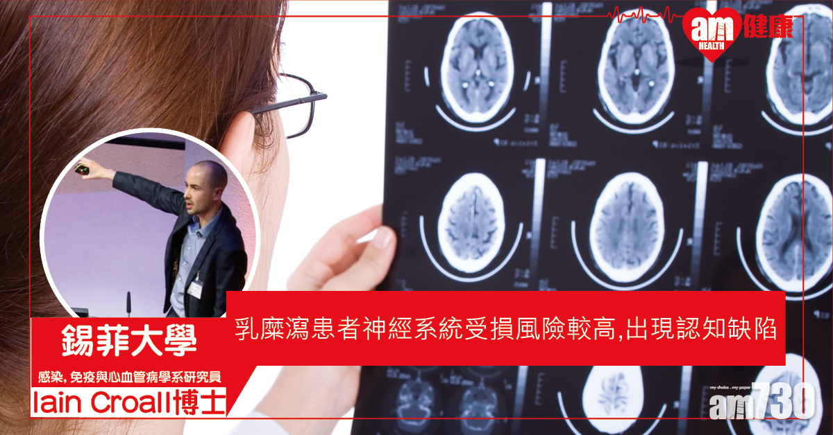 英研：乳糜瀉患者神經系統受損風險較高