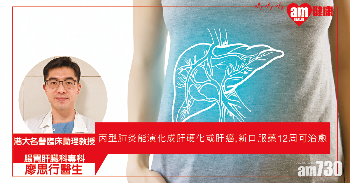 丙型肝炎 早醫可根治