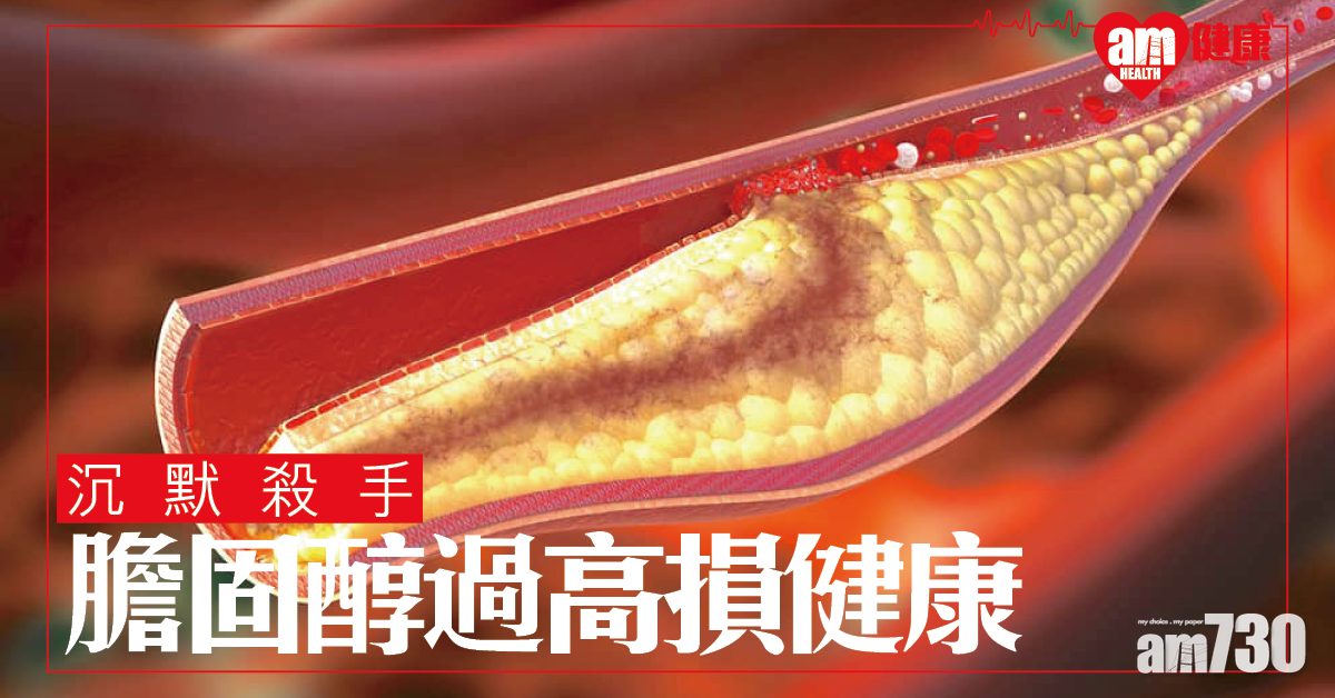 膽固醇過高損健康