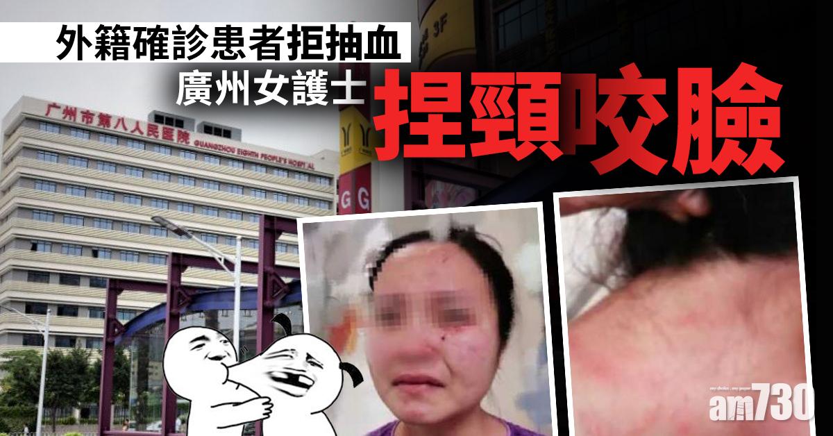 【新冠肺炎】外籍確診患者拒抽血 廣州女護士遭捏頸咬臉
