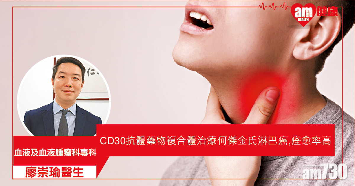 何傑金氏淋巴癌 治愈率高