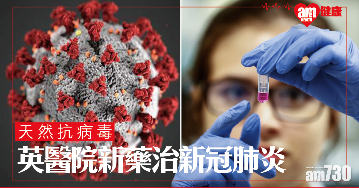 【新冠肺炎】英醫院試驗新藥治新冠肺炎