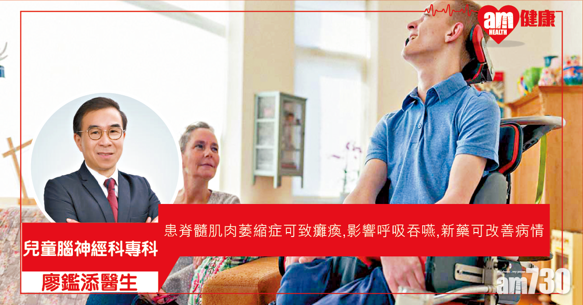 成年SMA新藥改善生活