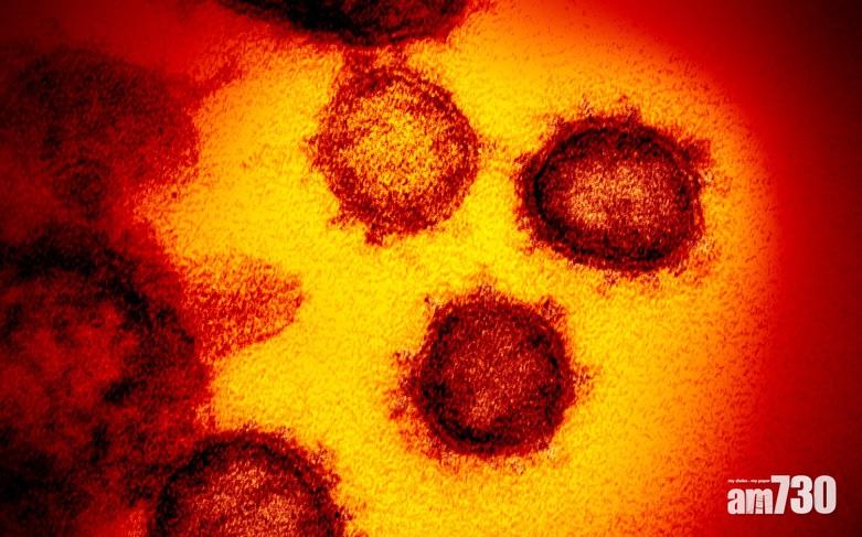 【新冠肺炎】德國情報：習近平要求世衛不要發布病毒人傳人訊息