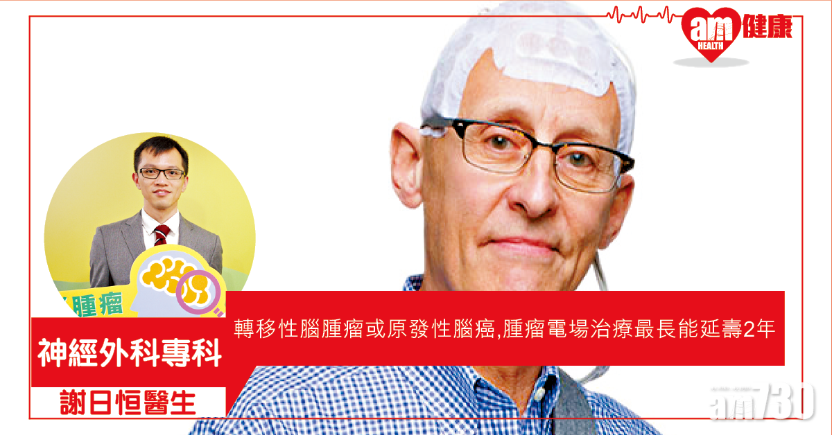 腦腫瘤 電場治療延壽命