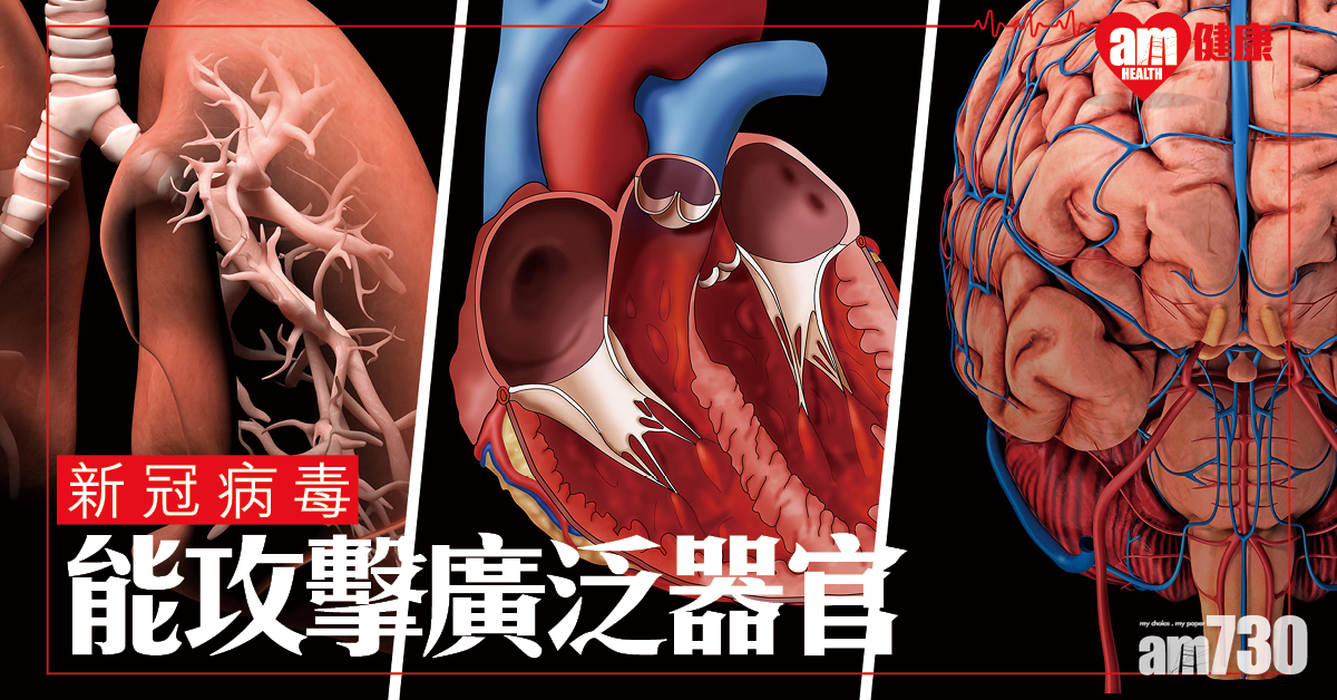 【新冠肺炎】研究：新冠病毒攻擊廣泛器官