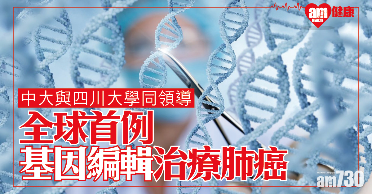 【全球首例】中大與四川大學共同領導 人體CRISPR基因編輯治療肺癌