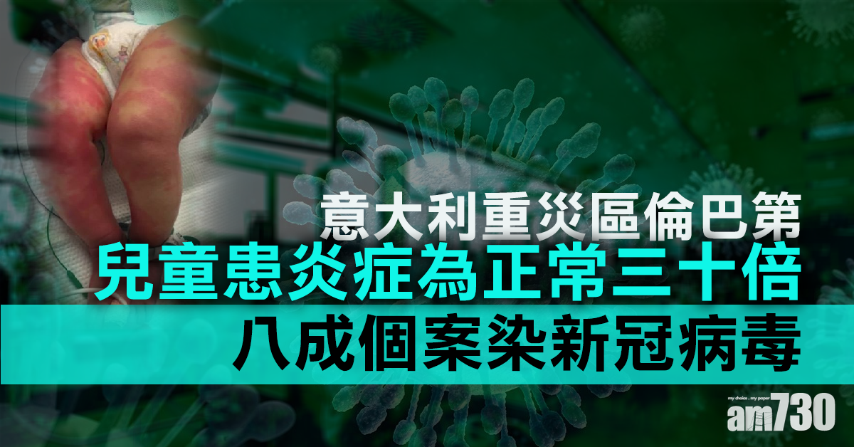 【新冠肺炎】意重災區倫巴第兒童患炎症為正常30倍  80%個案染新冠病毒