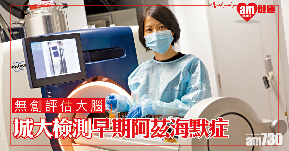 DGE-MRI 無創檢測早期阿茲海默症