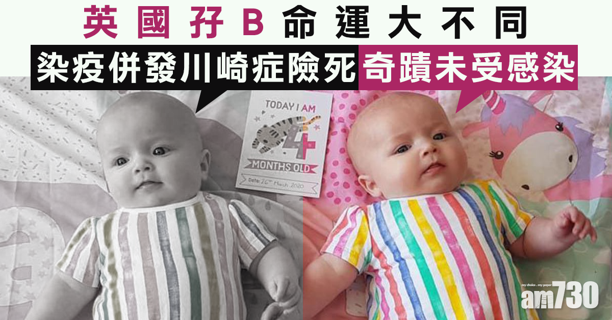 【新冠肺炎】英國孖B一人染疫併發川崎症險死  一人竟奇蹟無恙