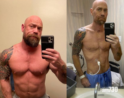 【新冠肺炎】護士與病毒搏鬥兩個月  暴瘦50磅拿不穩手機