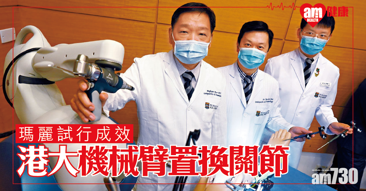 病人佳音 引入機械臂置換關節 港大︰免削骨「多咗」