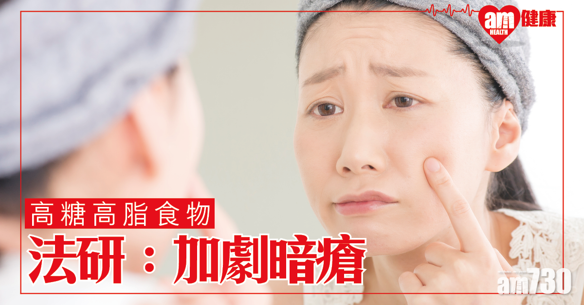 研究證高糖高脂食物加劇暗瘡
