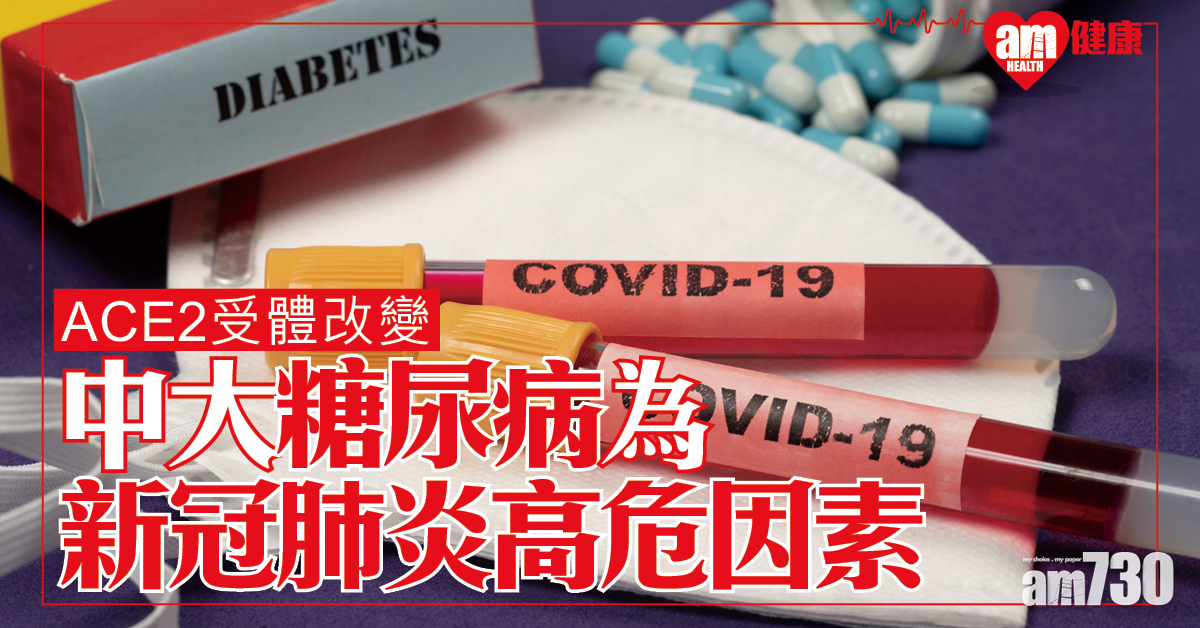 【新冠肺炎】中大研究指糖尿病或為感染高危因素