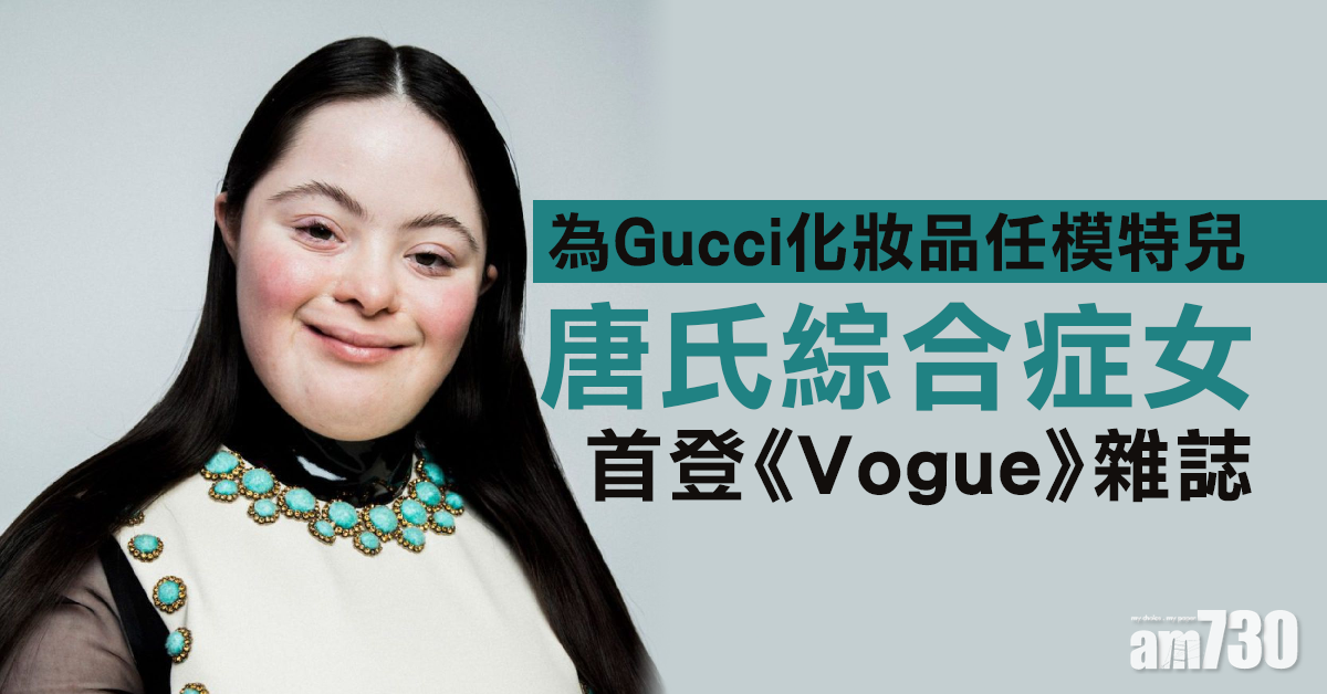 為Gucci化妝品任模特兒  唐氏綜合症女首登《Vogue》雜誌