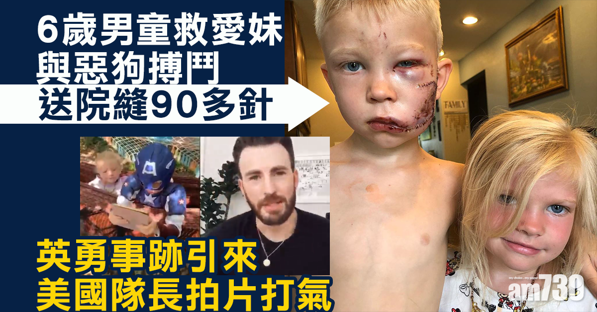 【好man啊】6歲男童救愛妹與惡狗搏鬥  送院縫90多針
