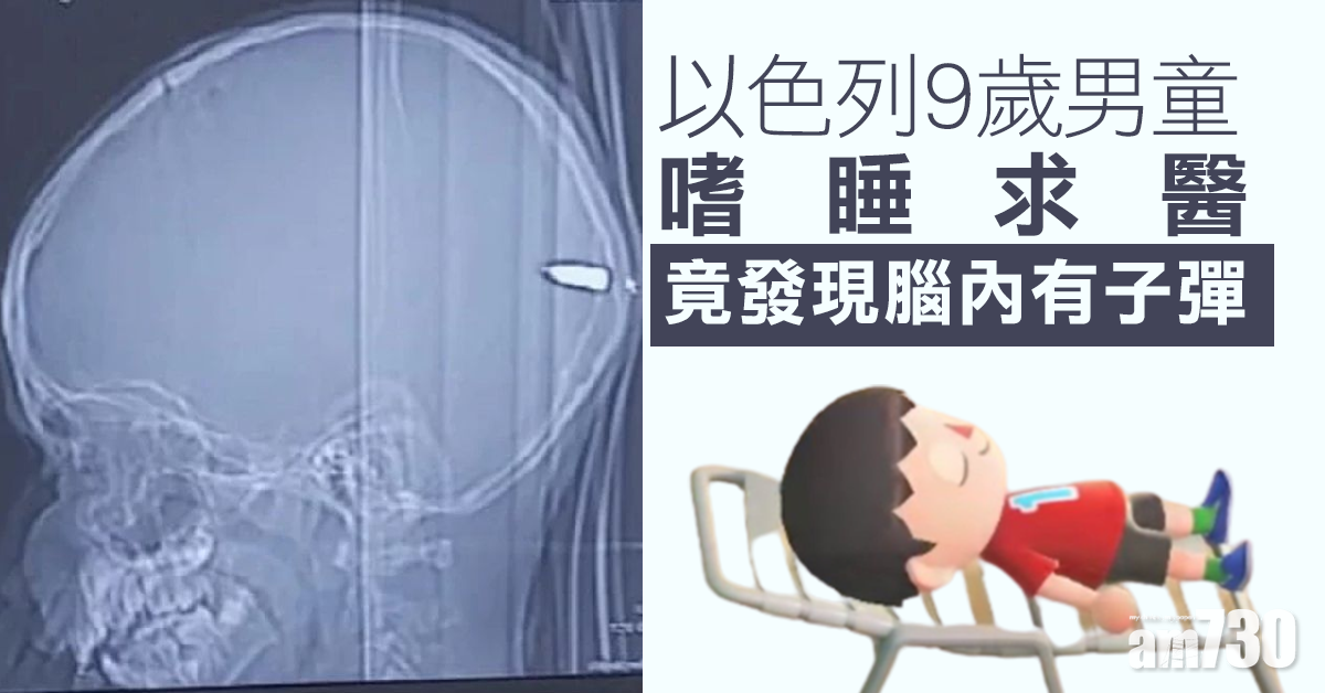 以色列9歲男童嗜睡求醫 竟發現腦內有子彈