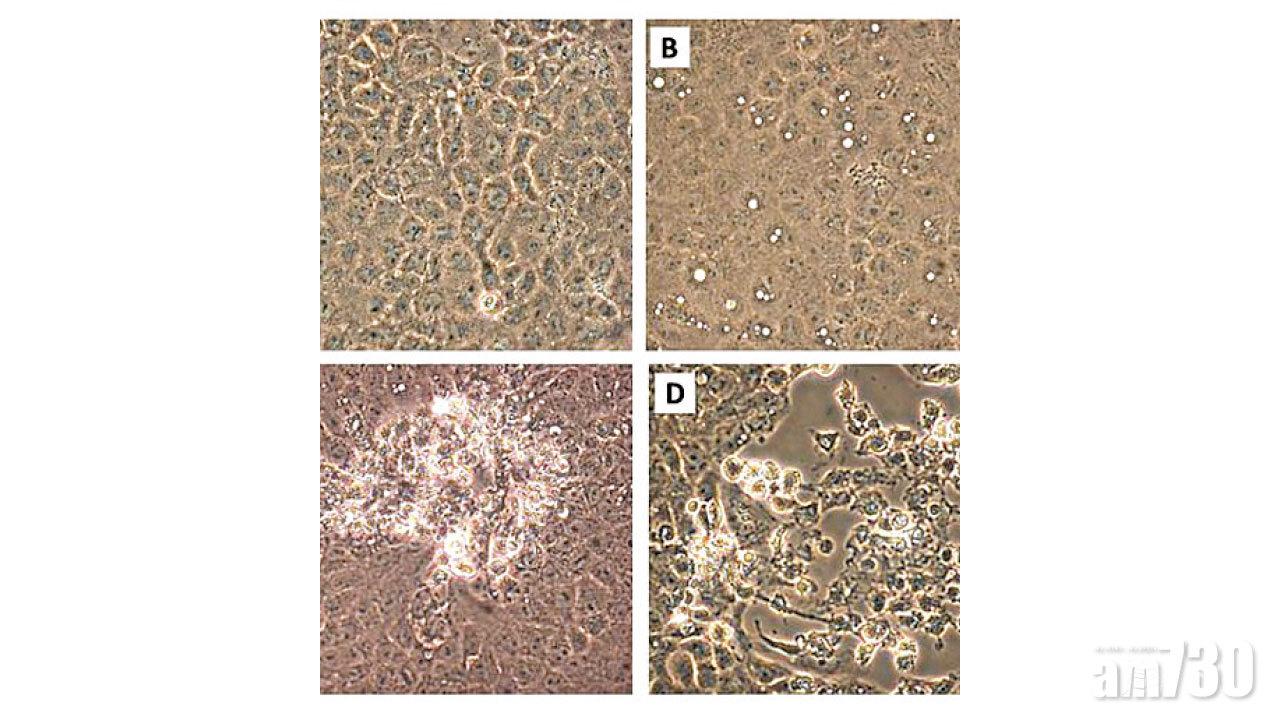 研究：患者帶毒飛沫傳至16呎外