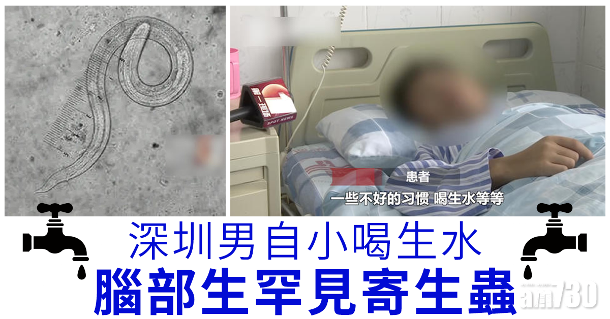 深圳男自小喝生水 腦部生罕見寄生蟲