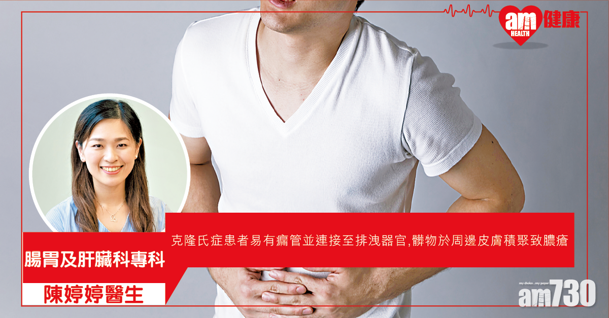 炎症性腸病 進取治療預防腸穿窿