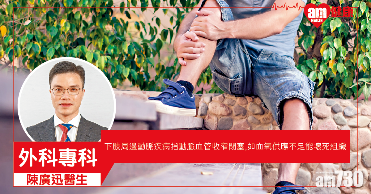 下肢周邊動脈疾病 嚴重須截肢