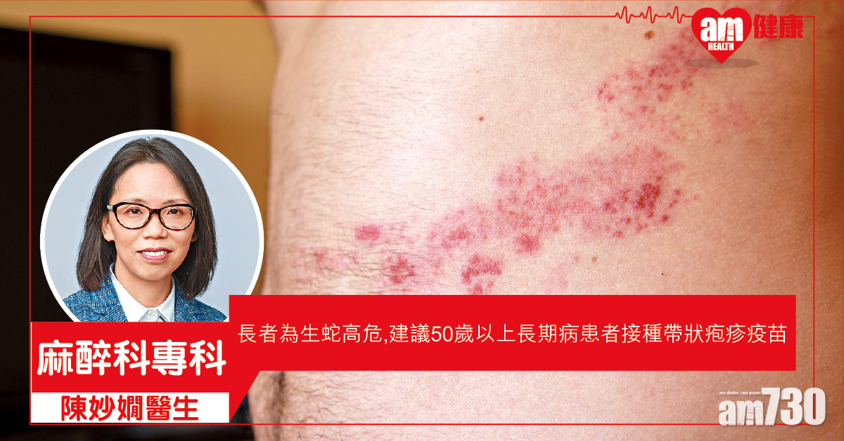 接種疫苗 預防長者生蛇