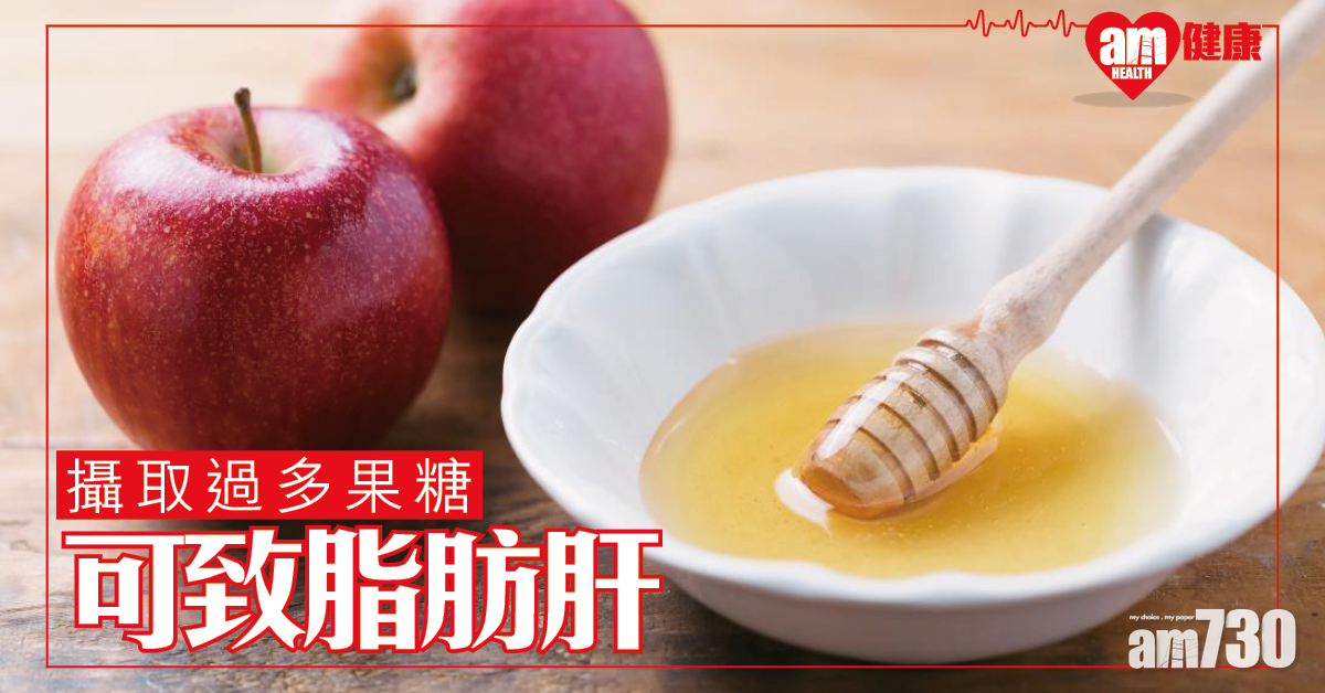 攝取過多果糖 可致脂肪肝