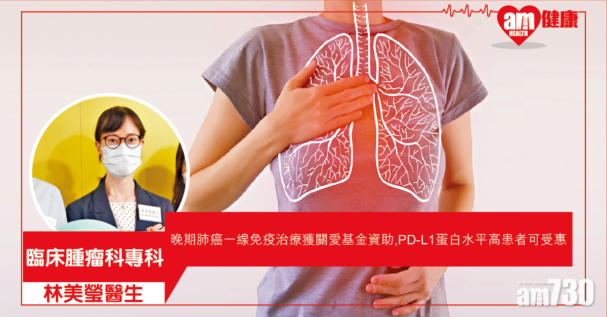 資助免疫治療 晚期肺癌患者減憂慮