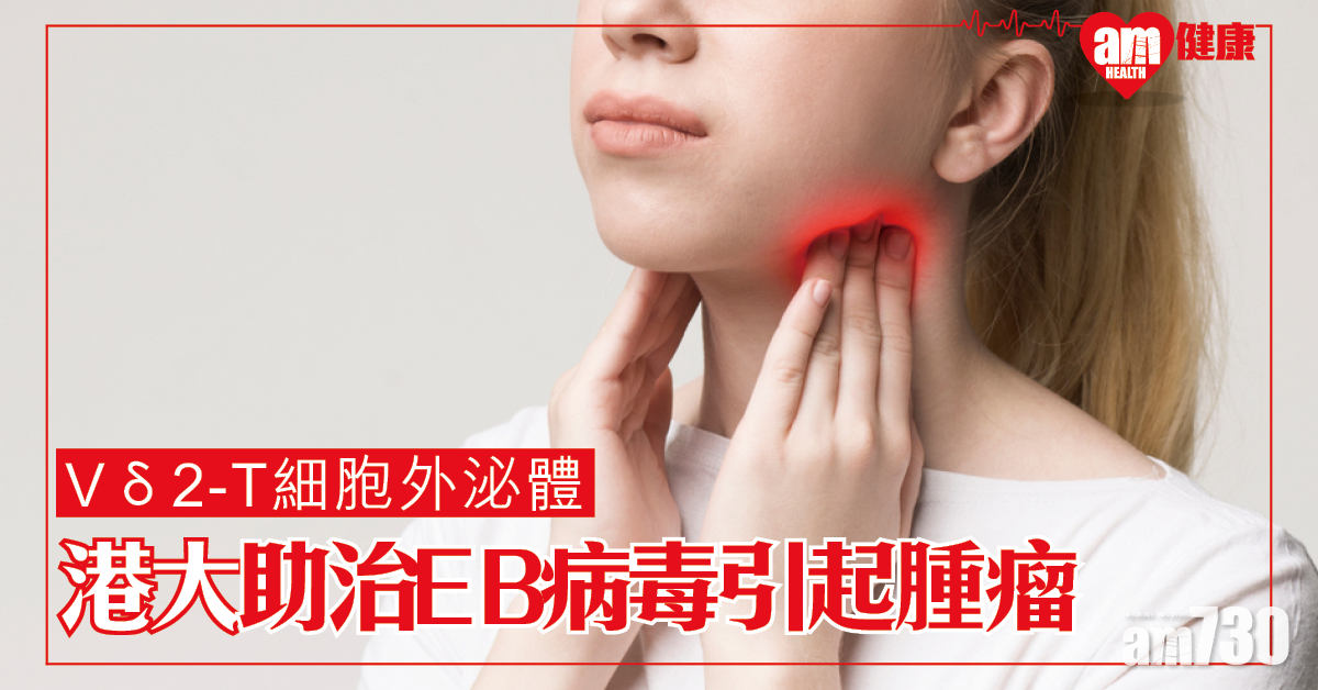 Vδ2-T細胞外泌體 港大研治療EB病毒相關腫瘤新方法