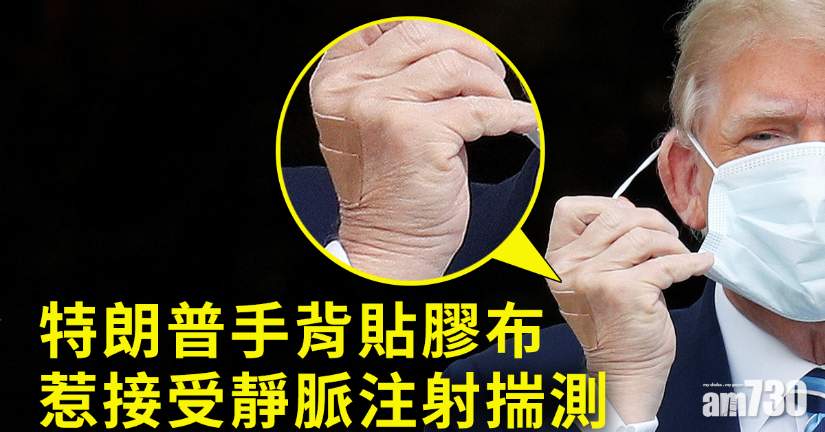 【特朗普確診】特朗普手背貼膠布  惹接受靜脈注射揣測