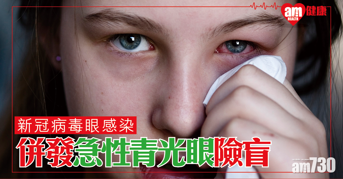 【新冠肺炎】新冠病毒眼感染 婦併發急性青光眼險盲