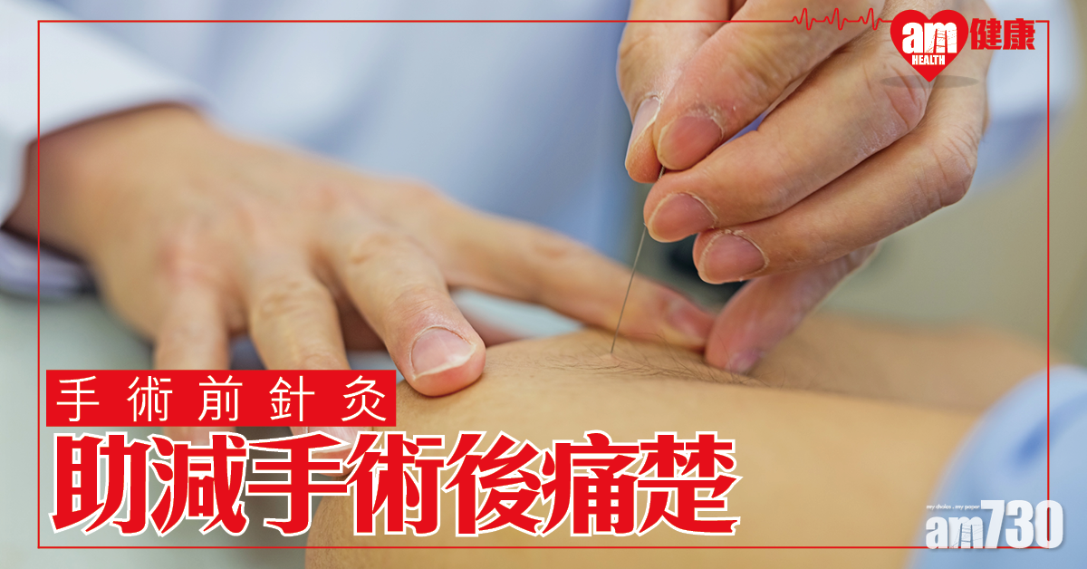 手術前針灸 或有助減手術後痛楚