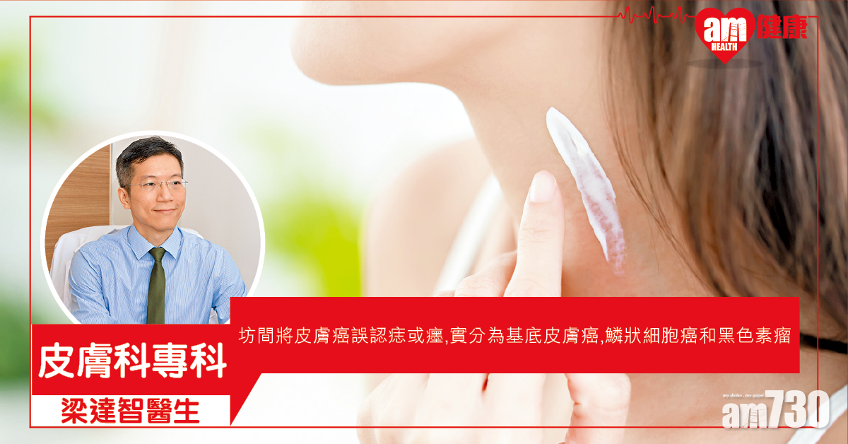 出門用太陽油搽面頸預防皮膚癌