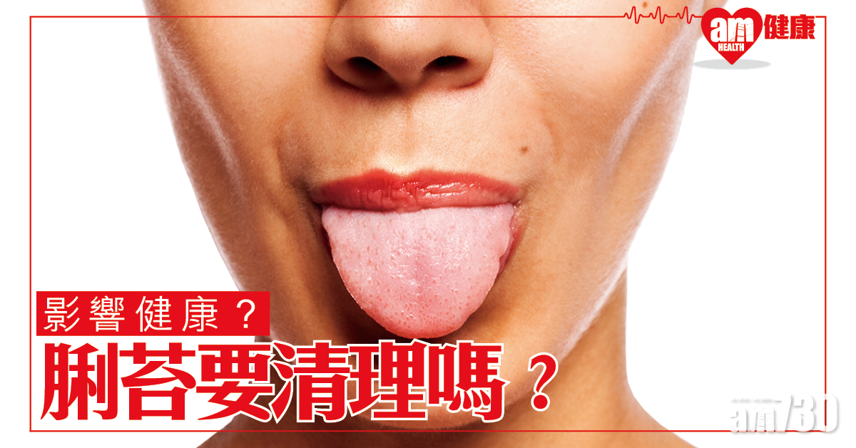 脷苔要清理嗎？