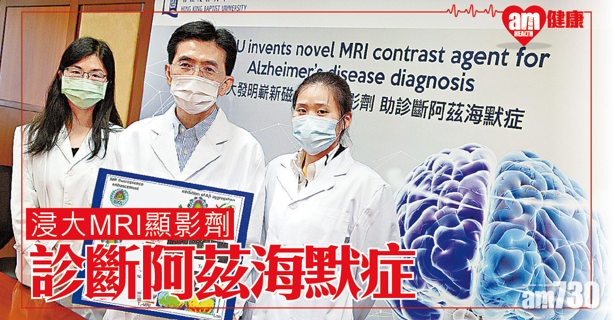 香港研發 研新MRI顯影劑 浸大團隊︰可斷阿茲海默症