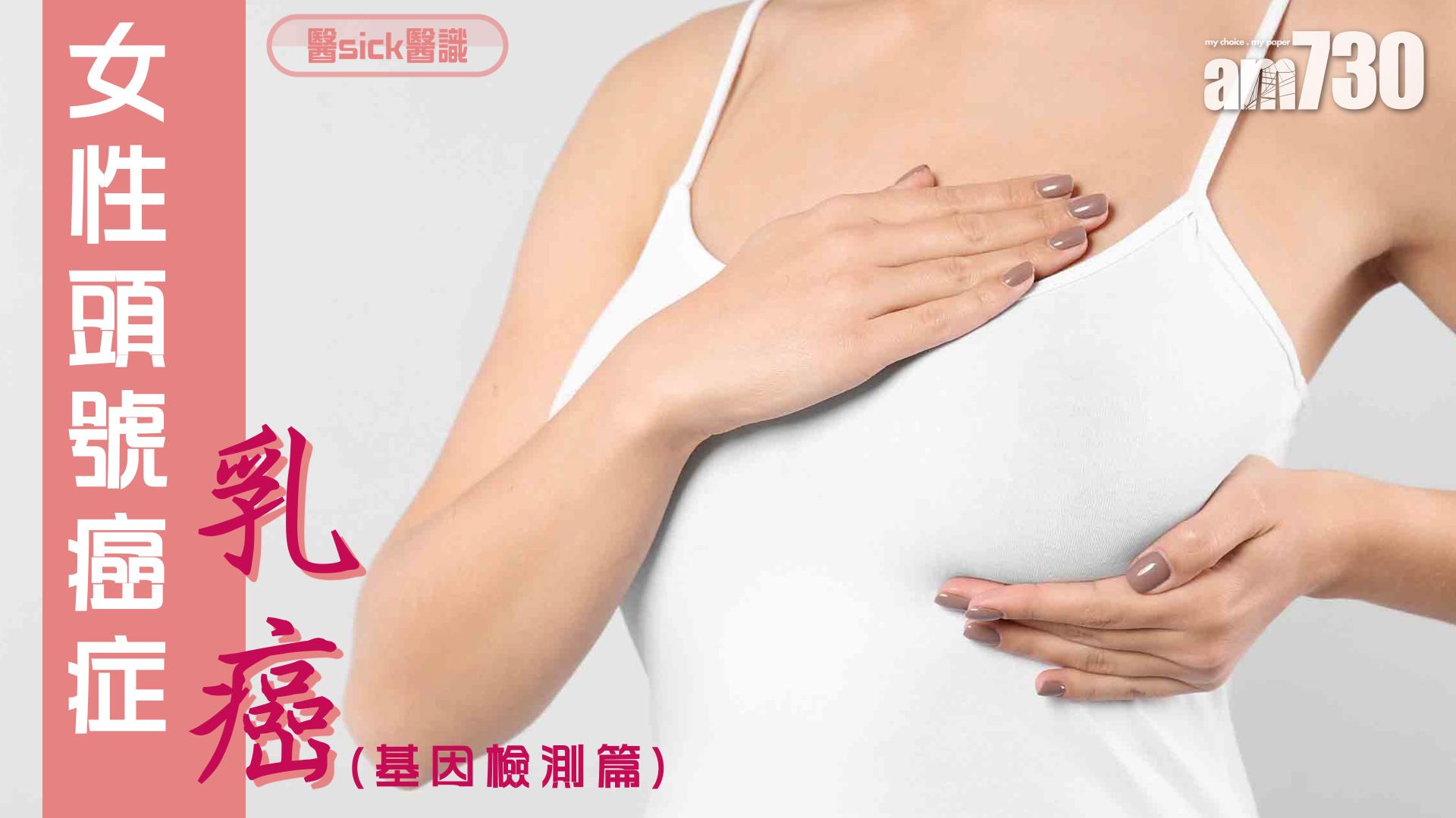 女性頭號癌症——乳癌(基因檢測篇)