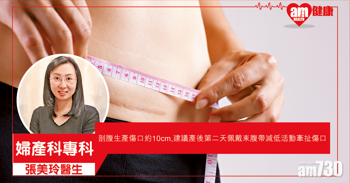 剖腹產比率近四成 謹慎護理不留痕