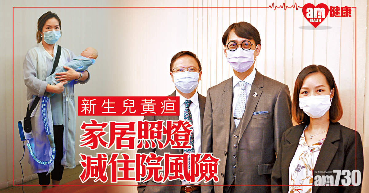 家居治療新生兒黃疸 減母嬰分離